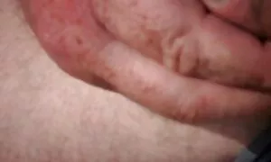 Herkkä, sairaanhoitaja, karvaisia pilluja määräsi potilaille lämpimän hoitotoimenpiteen.